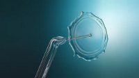 Oralni tuš PHILIPS HX3911/40, Čišćenje, Dubinsko čišćenje, Osjetljivo, bijeli