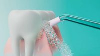 Oralni tuš PHILIPS HX3911/40, Čišćenje, Dubinsko čišćenje, Osjetljivo, bijeli